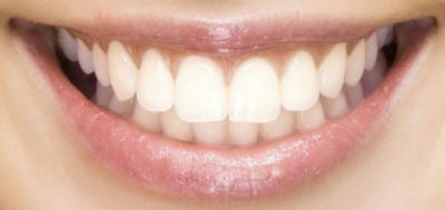 sorriso dentista